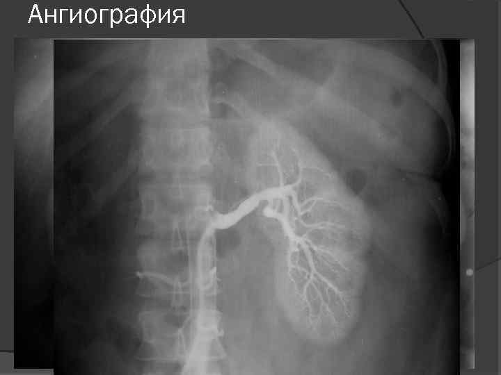 Ангиография 