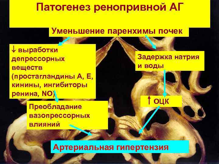 Патогенез ренопривной АГ Уменьшение паренхимы почек выработки депрессорных веществ (простагландины А, Е, кинины, ингибиторы