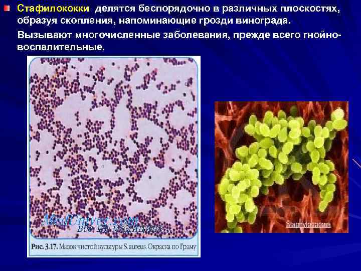Стафилококки является причиной. Стафилококки делятся. Стафилококки располагаются в виде. Стафилококк гроздья винограда. Стафилококки Тип питания.