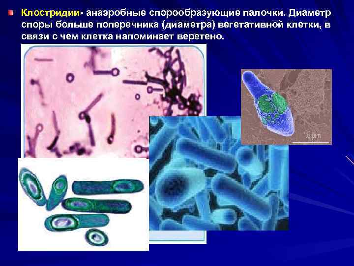 Форма спор бактерий. Палочки бациллы клостридии. Клостридии микробиология. Бациллы и клостридии. Спорообразующие анаэробы клостридии.