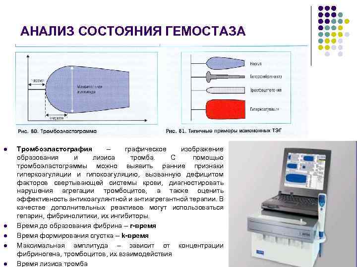 АНАЛИЗ СОСТОЯНИЯ ГЕМОСТАЗА l l l Тромбоэластография – графическое изображение образования и лизиса тромба.