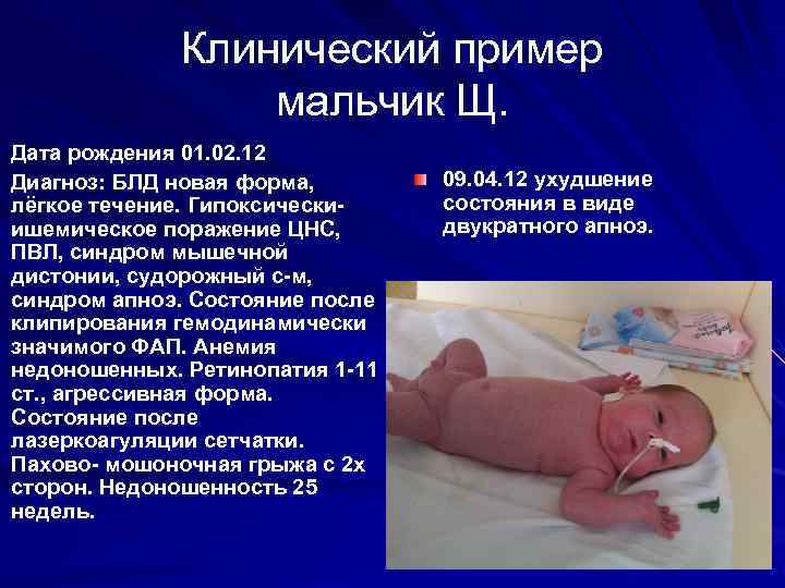 Клинический пример мальчик Щ. Дата рождения 01. 02. 12 Диагноз: БЛД новая форма, лёгкое