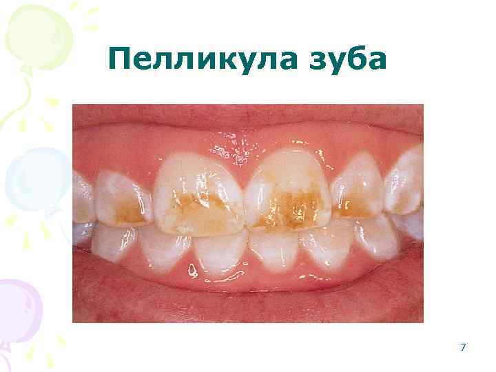 Пелликула зуба 7 
