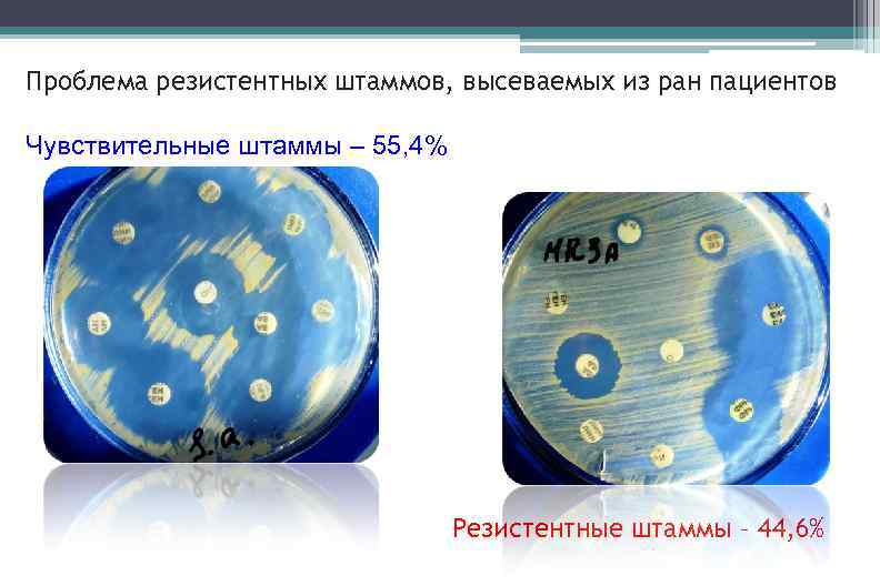 Проблема резистентных штаммов, высеваемых из ран пациентов Чувствительные штаммы – 55, 4% Резистентные штаммы