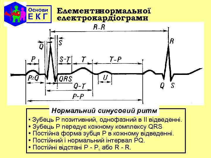 Основи ЕКГ Елементинормальної електрокардіограми Нормальний синусовий ритм • Зубець Р позитивний, однофазний в ІІ