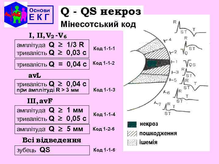 Основи ЕКГ Q - QS некроз Мінесотський код І, ІІ, V 2 -V 6