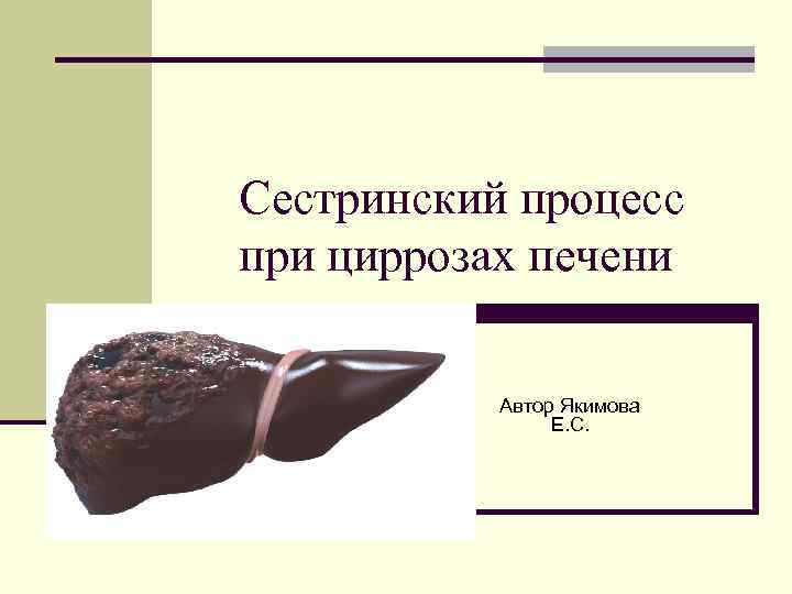 Сестринский процесс при циррозах печени Автор Якимова Е. С. Сестринский процесс при циррозах печени Автор Якимова Е. С.