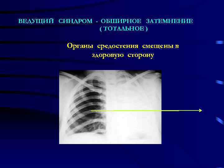 Лучевая диагностика средостения презентация