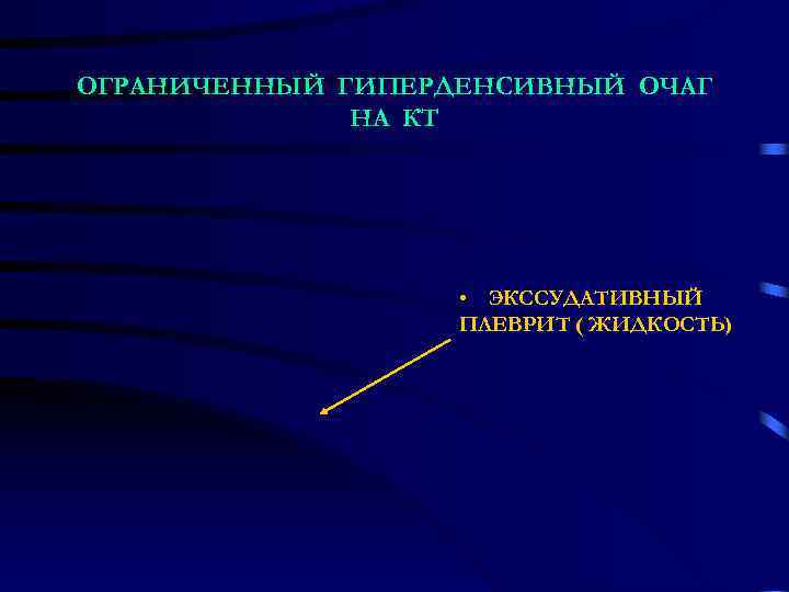ОГРАНИЧЕННЫЙ ГИПЕРДЕНСИВНЫЙ ОЧАГ    НА КТ     • ЭКССУДАТИВНЫЙ