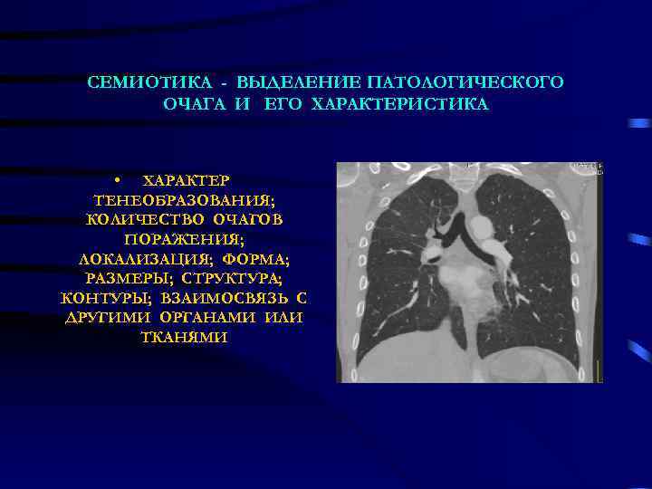  СЕМИОТИКА - ВЫДЕЛЕНИЕ ПАТОЛОГИЧЕСКОГО  ОЧАГА И ЕГО ХАРАКТЕРИСТИКА  • ХАРАКТЕР ТЕНЕОБРАЗОВАНИЯ;