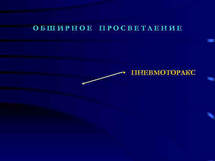 ОБШИРНОЕ ПРОСВЕТЛЕНИЕ   • ПНЕВМОТОРАКС 