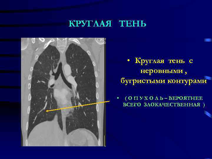 КРУГЛАЯ ТЕНЬ    • Круглая тень с   неровными , 