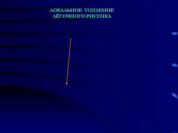 ЛОКАЛЬНОЕ УСИЛЕНИЕ ЛЁГОЧНОГО РИСУНКА 