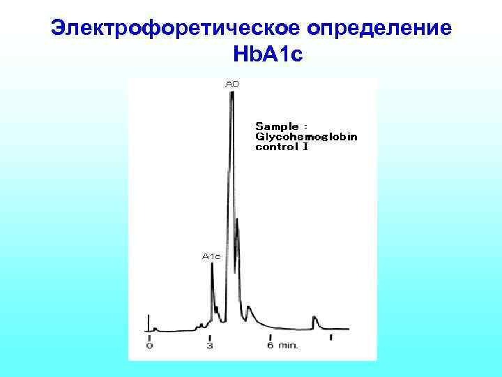 Электрофоретическое определение Hb. A 1 c 