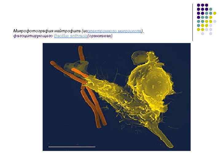 Микрофотография нейтрофила (изэлектронного микроскопа),  фагоцитирующего Bacillus anthracis(оранжевая). 