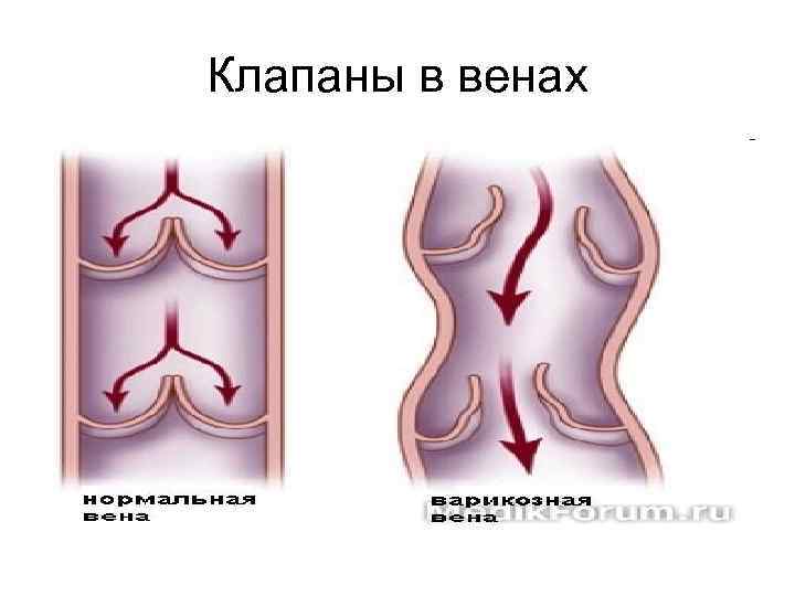 Клапаны в венах 