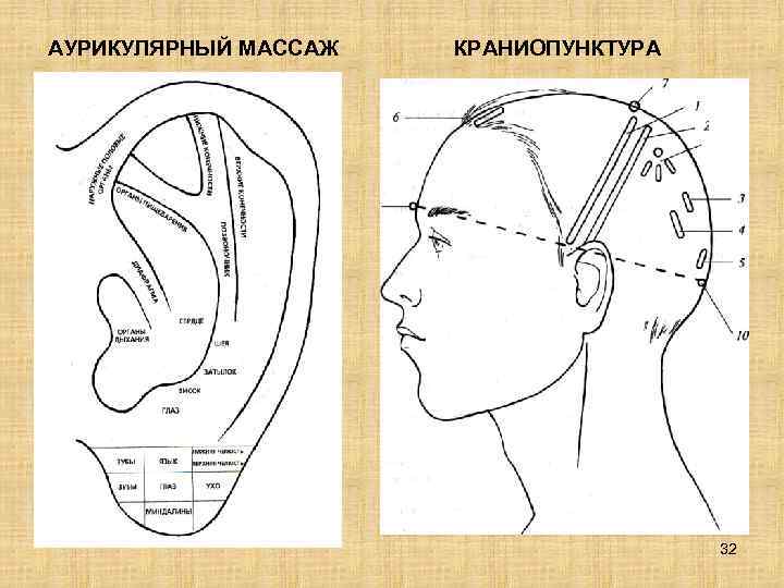 АУРИКУЛЯРНЫЙ МАССАЖ  КРАНИОПУНКТУРА    32 