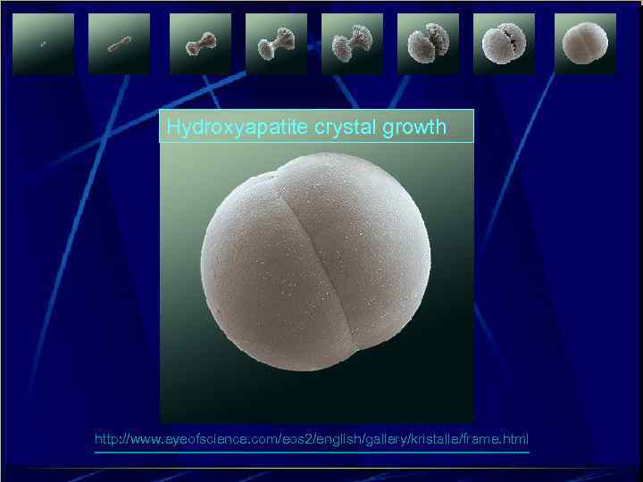   Hydroxyapatite crystal growth http: //www. eyeofscience. com/eos 2/english/gallery/kristalle/frame. html 