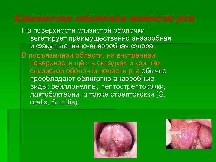 Слизистая оболочка полости рта На поверхности слизистой оболочки  вегетирует преимущественно анаэробная  и