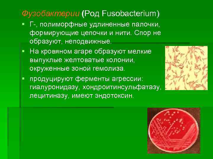 Презентация на тему микрофлора полости рта