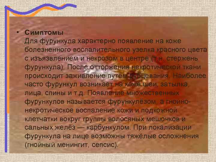  • Симптомы Для фурункула характерно появление на коже болезненного воспалительного узелка красного цвета