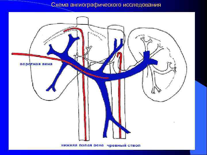 Схема ангиографического исследования 