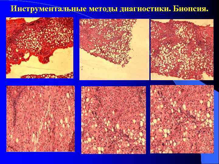 Инструментальные методы диагностики. Биопсия. 