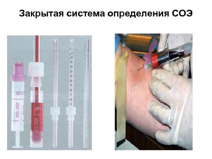 Закрытая система определения СОЭ 