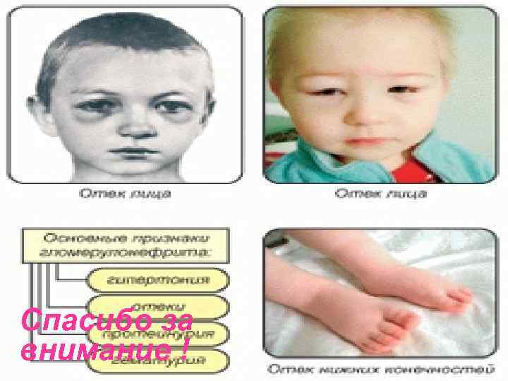  Спасибо за внимание!  Спасибо за внимание ! 