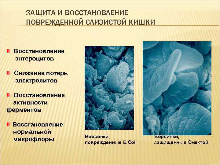 ЗАЩИТА И ВОССТАНОВЛЕНИЕ ПОВРЕЖДЕННОЙ СЛИЗИСТОЙ КИШКИ Восстановление энтероцитов Снижение потерь электролитов Восстановление активности ферментов