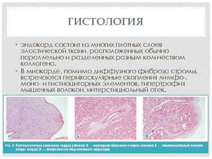    ГИСТОЛОГИЯ  • эндокард состоит из многих плотных слоев  эластической