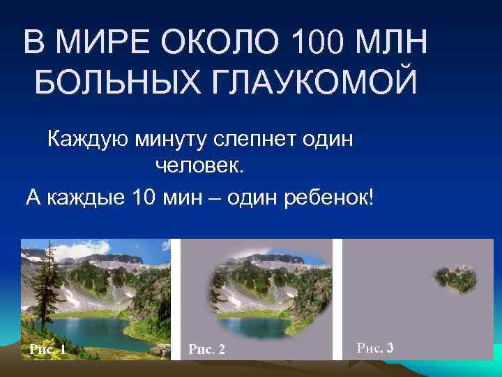 В МИРЕ ОКОЛО 100 МЛН БОЛЬНЫХ ГЛАУКОМОЙ  Каждую минуту слепнет один  человек.