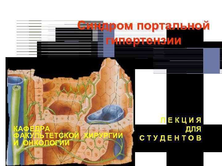 Синдром портальной гипертензии КАФЕДРА ФАКУЛЬТЕТСКОЙ ХИРУРГИИ И ОНКОЛОГИИ ЛЕКЦИЯ ДЛЯ СТУДЕНТОВ 