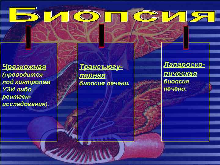 Чрезкожная (проводится под контролем УЗИ либо рентгенисследования). Трансъюгулярная биопсия печени. Лапароскопическая биопсия печени. 