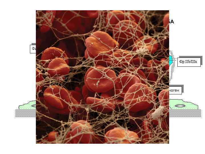МЕХАНИЗМ ОБРАЗОВАНИЯ ВТОРИЧНОГО ТРОМБА Фибрин Gp IIb/IIIa Фибриноген Gp Ib/IX 