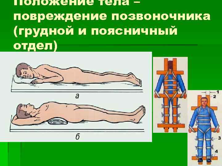 Положение тела – повреждение позвоночника (грудной и поясничный отдел) 