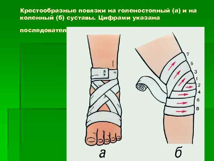 Крестообразные повязки на голеностопный (а) и на коленный (б) суставы. Цифрами указана последовательность наложения