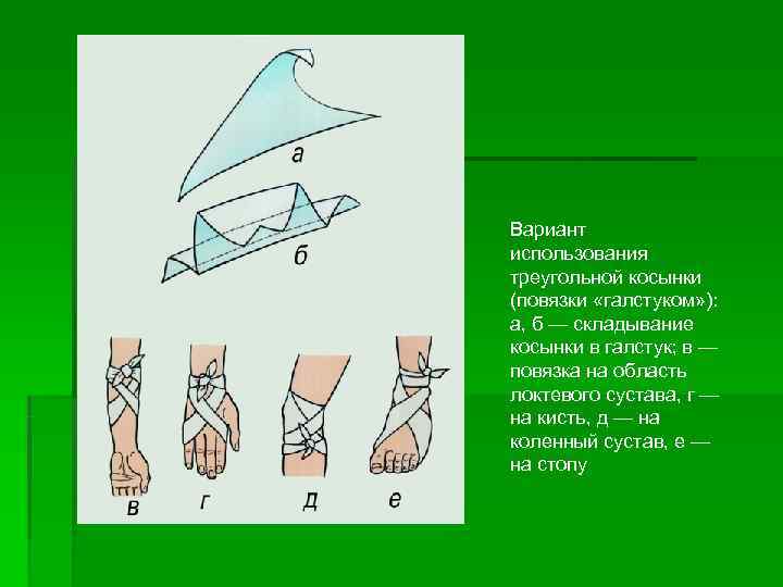Вариант использования треугольной косынки (повязки «галстуком» ):  а, б — складывание косынки в