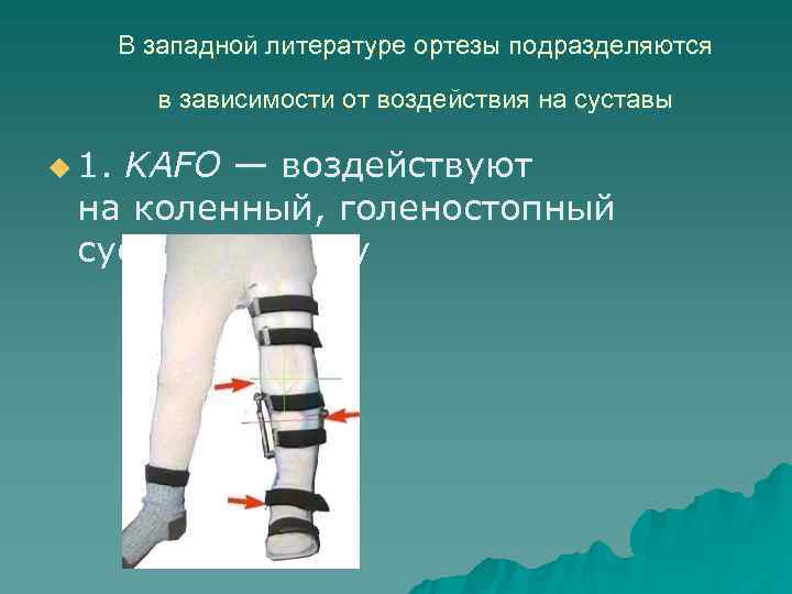 В западной литературе ортезы подразделяются в зависимости от В западной литературе ортезы подразделяются в зависимости от