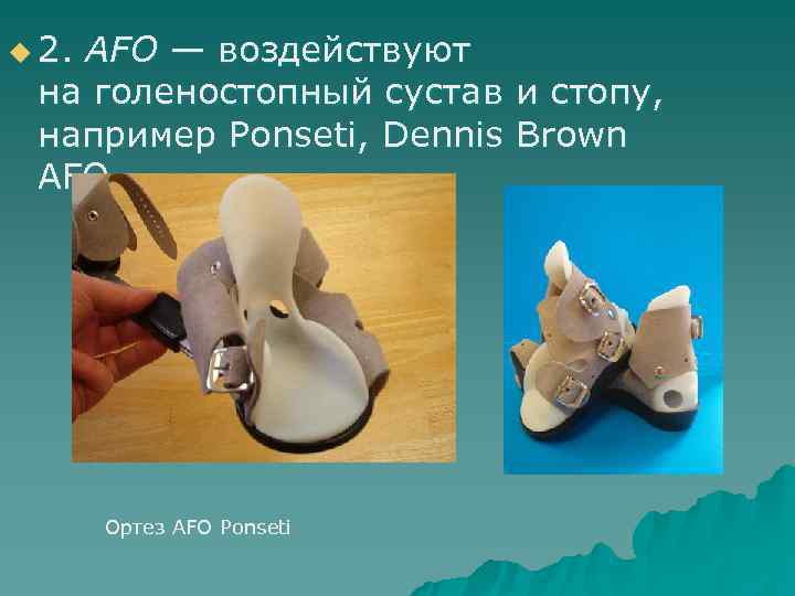 u 2. AFO — воздействуют на голеностопный сустав и стопу, например Ponseti, u 2. AFO — воздействуют на голеностопный сустав и стопу, например Ponseti,