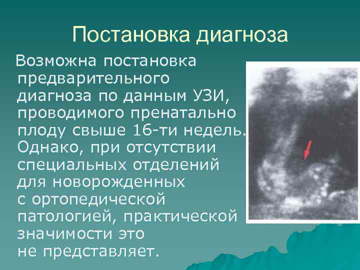 Постановка диагноза Возможна постановка предварительного диагноза по данным УЗИ, Постановка диагноза Возможна постановка предварительного диагноза по данным УЗИ,