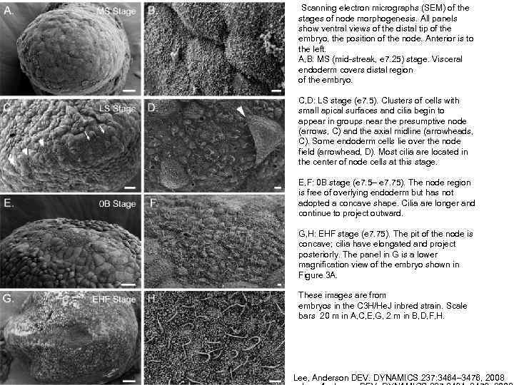 Scanning electron micrographs (SEM) of the stages of node morphogenesis. All panels show ventral