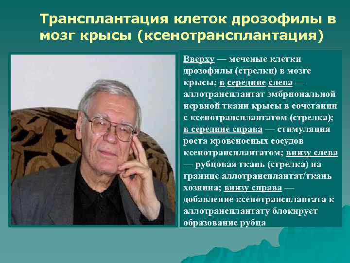 Трансплантация клеток дрозофилы в мозг крысы (ксенотрансплантация)    Вверху — меченые клетки