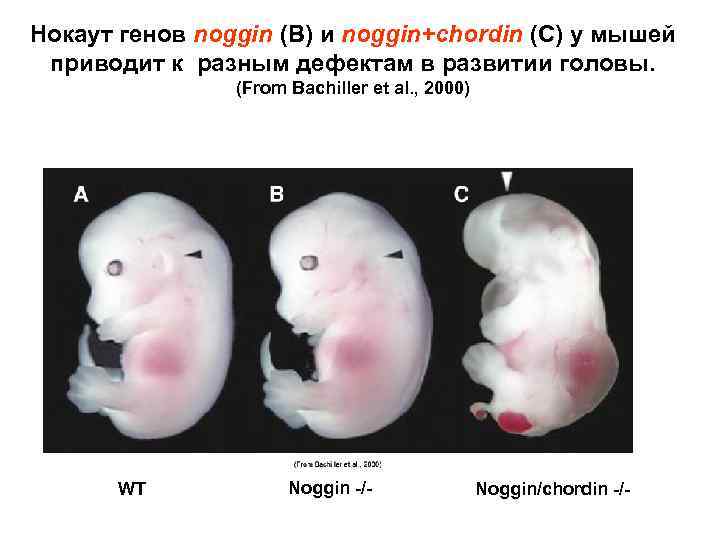 Нокаут генов noggin (В) и noggin+chordin (С) у мышей приводит к разным дефектам в