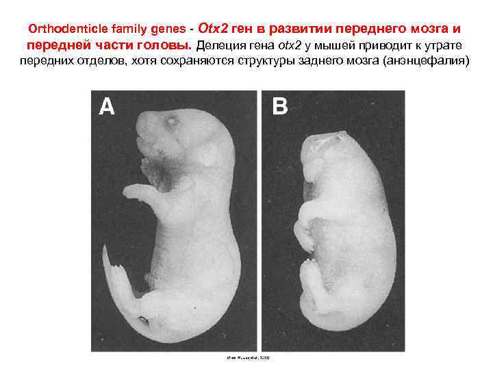 Orthodenticle family genes - Otx 2 ген в развитии переднего мозга и передней части