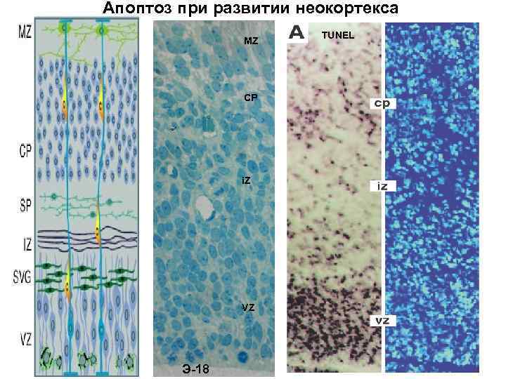 Апоптоз при развитии неокортекса MZ CP i. Z VZ Э-18 TUNEL 