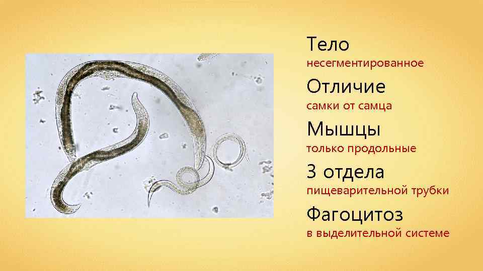 Тело несегментированное Отличие самки от самца Мышцы только продольные 3 отдела пищеварительной трубки Фагоцитоз