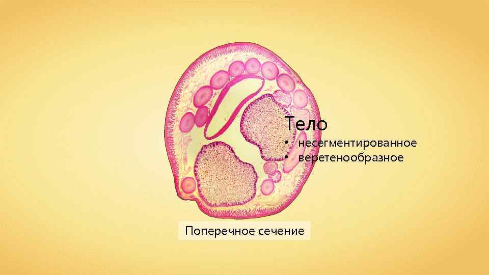 Тело • несегментированное • веретенообразное Поперечное сечение 
