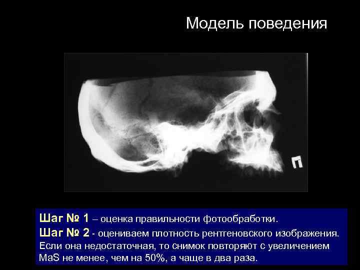 Модель поведения Шаг № 1 – оценка правильности фотообработки. Шаг № 2 - оцениваем
