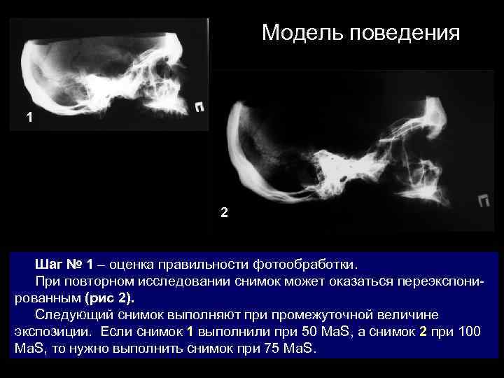 Модель поведения 1 2 Шаг № 1 – оценка правильности фотообработки. При повторном исследовании